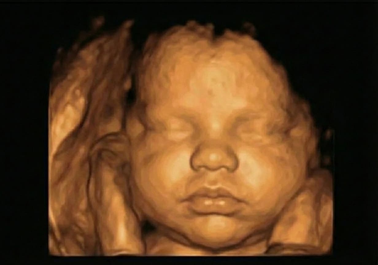 3D scan ultrasound Week 28